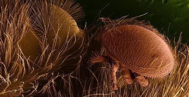 varroa